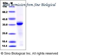 Sino Biological 10486-H08H image 1