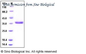 Sino Biological 10487-H08H image 1