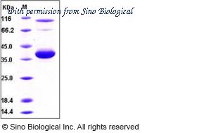 Sino Biological 10098-H01H2 image 1