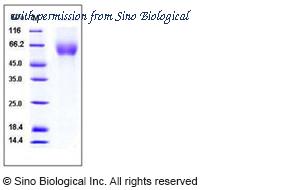 Sino Biological 50259-M08H image 1