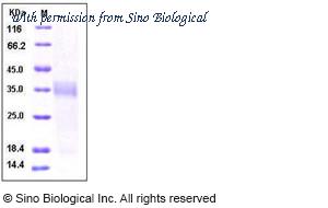 Sino Biological 10188-HCCH image 1