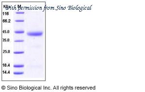 Sino Biological 10187-HCCH image 1
