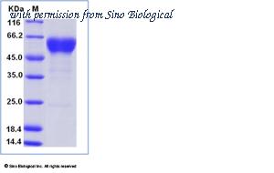 Sino Biological 10217-H02H image 1