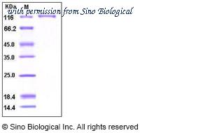 Sino Biological 10218-H02H image 1