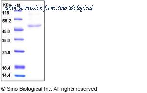 Sino Biological 10323-H08H image 1