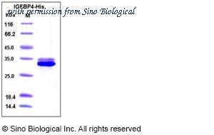 Sino Biological 10967-H08H image 1