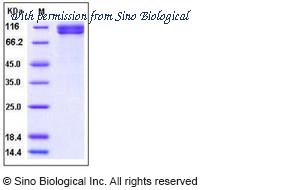 Sino Biological 10489-H02H image 1