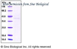 Sino Biological 10696-HCCH image 1