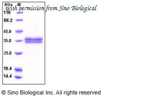 Sino Biological 10199-H08H image 1