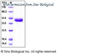 Sino Biological 10287-H08H image 1