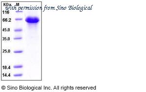 Sino Biological 10295-H08H image 1