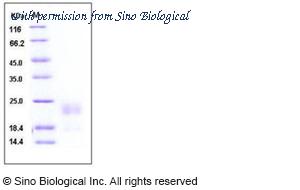 Sino Biological 50042-M08H image 1