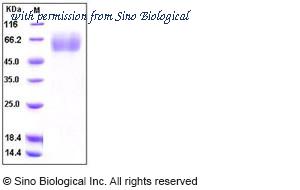 Sino Biological 10427-H07H image 1