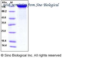 Sino Biological 10628-H08H image 1