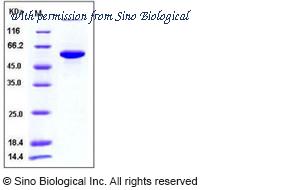 Sino Biological 10827-H08H image 1