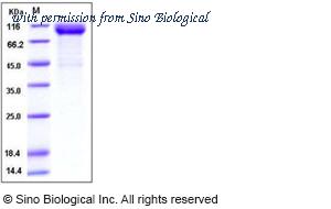 Sino Biological 11063-H03H image 1