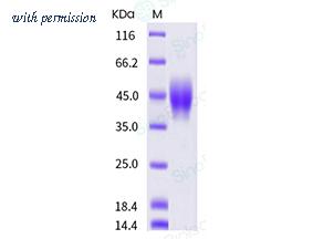 Sino Biological 10402-H08H image 1