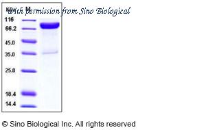 Sino Biological 10945-H03H image 1