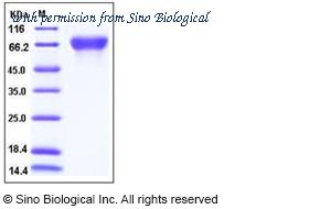 Sino Biological 10852-H08H image 1