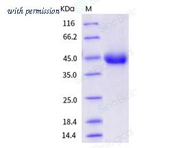 Sino Biological 10417-H08H image 1