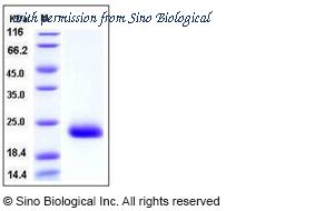 Sino Biological 50267-M08H image 1