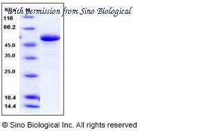 Sino Biological 10842-H09E image 1