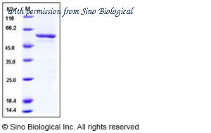 Sino Biological 11217-H09B image 1