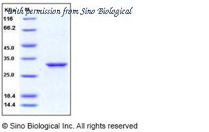 Sino Biological 10842-HNCE image 1
