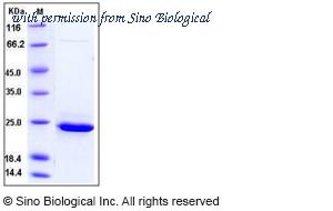 Sino Biological 11194-H08E image 1