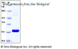 Sino Biological 11222-HNCE image 1
