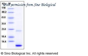 Sino Biological 11140-HNAE image 1