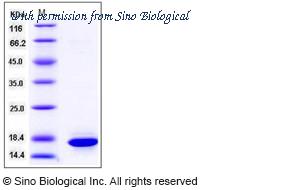 Sino Biological 11231-HNAE image 1
