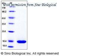 Sino Biological 11235-H08H image 1