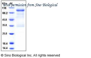 Sino Biological 10213-H03H image 1