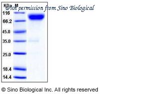 Sino Biological 50639-M02H image 1