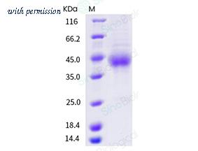 Sino Biological 10481-H08H image 1