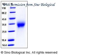 Sino Biological 50613-M08H image 1