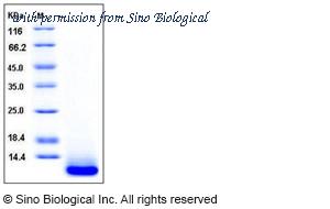 Sino Biological 11669-H08H image 1