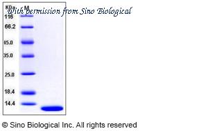 Sino Biological 10991-HNAE image 1