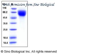 Sino Biological 11683-V08H1 image 1