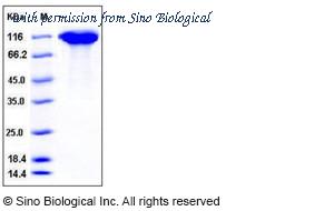 Sino Biological 50423-M08H image 1