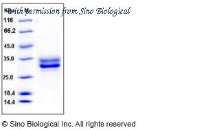 Sino Biological 50465-M08H image 1