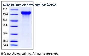 Sino Biological 50474-M08H image 1