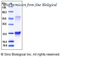 Sino Biological 50364-M07E image 1
