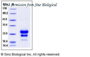 Sino Biological 11485-H07H image 1