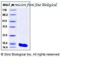 Sino Biological 11542-H08H image 1