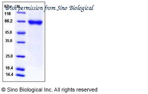 Sino Biological 11387-H08H image 1