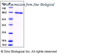 Sino Biological 10641-H09B image 1