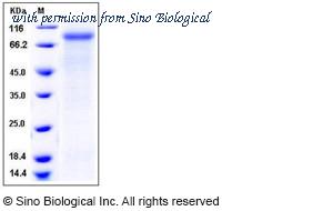 Sino Biological 10133-H08H image 1
