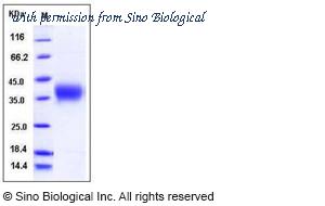 Sino Biological 10257-H08H image 1